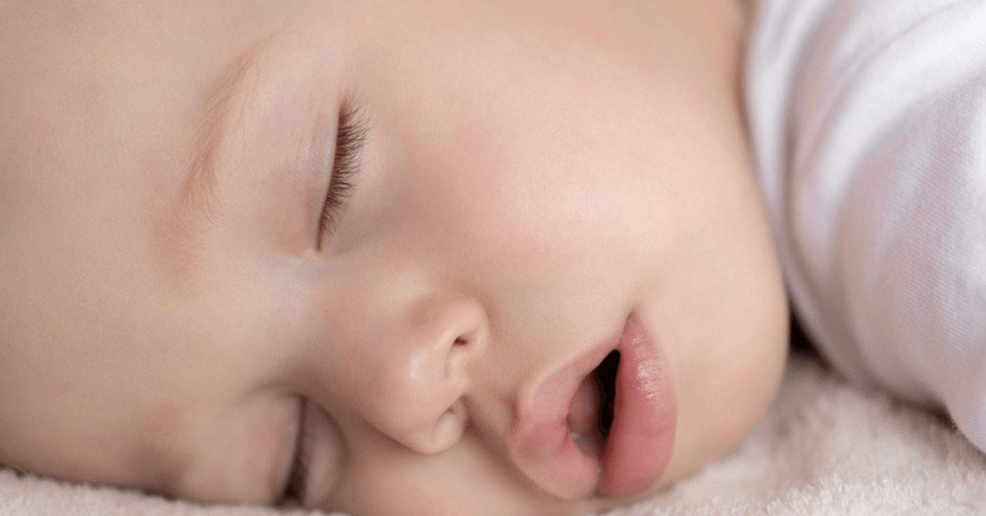 Sleeping baby breathing through mouth – a common early sign of orthodontic or airway issues in children