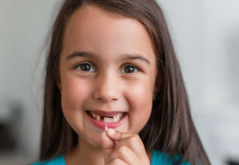 Smiling child holding a fallen baby tooth showing early loss of baby teeth